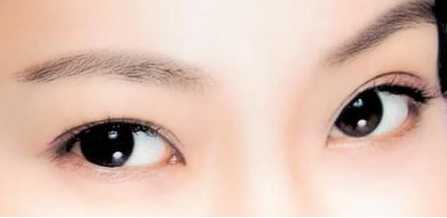 武汉哪家整形美容医院做韩式双眼皮修复最好?手术价格多少钱?