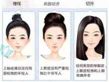 整容医院上海九院做韩式埋线双眼皮美容整形手术价格是多少钱?