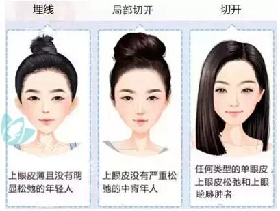 整容医院上海九院做韩式埋线双眼皮美容整形手术价格是多少钱?