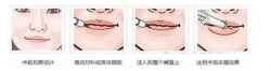韩式花瓣唇和半永久嘟嘟嘴唇是怎么做出来的?整形过程图片欣赏