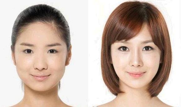 重庆市新桥_华美正规医院注射瘦脸针手术的价格费用大概是多少钱?