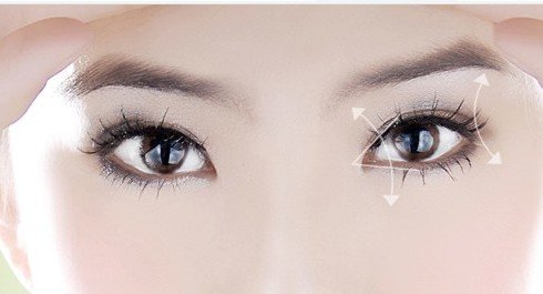 双眼皮手术的恢复时间是多长?