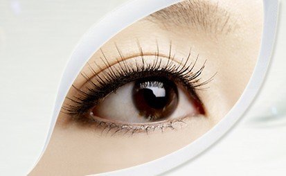 双眼皮手术恢复期的注意事项