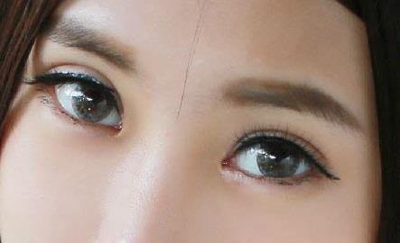 中国人的双眼皮有几种