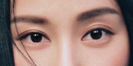 恢复快的韩国双眼皮（图）
