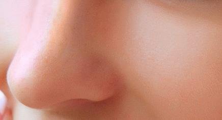膨体隆鼻有副作用吗？
