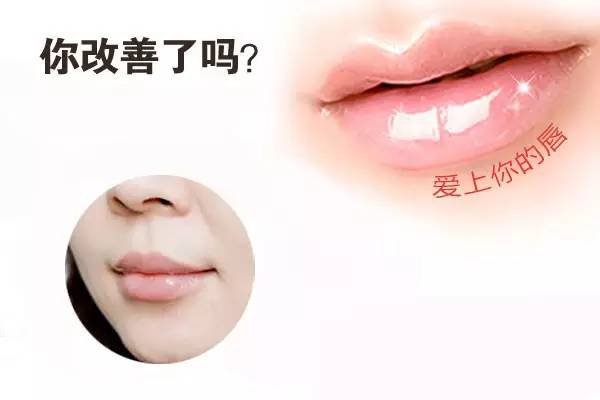北京哪个医院注射玻尿酸丰嘴唇最好?打的玻尿酸吸收的快不快?