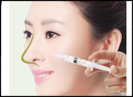整形整容医院上海九院注射微晶瓷隆鼻_玻尿酸隆鼻尖手术价格表