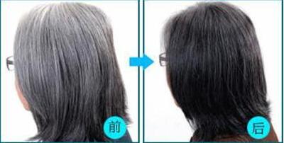 吃黑豆_黑枸杞真的能让头发变黑吗?怎么样吃可以有效的治疗白头发