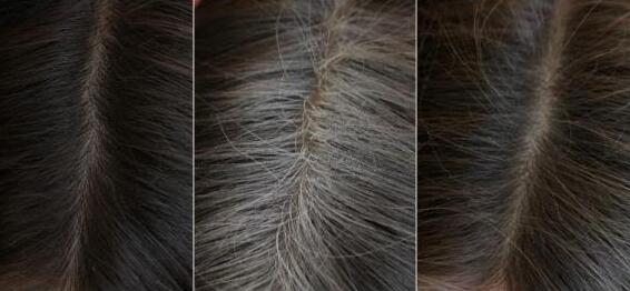 如何能使白发变黑头发?黑发茶_黑发药酒是真的有效吗?黑发小秘诀
