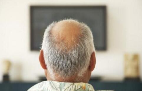老年人脱头发是怎么回事?什么原因引起的?吃什么好?治疗方法偏方