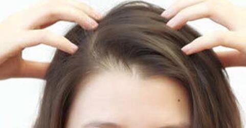青春期女生脱发严重怎么办?有哪些的原因?剪光头发还可以长吗?