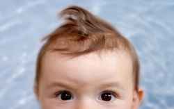 婴儿的头发长得慢长的不均匀是什么原因引起的?怎么办啊?