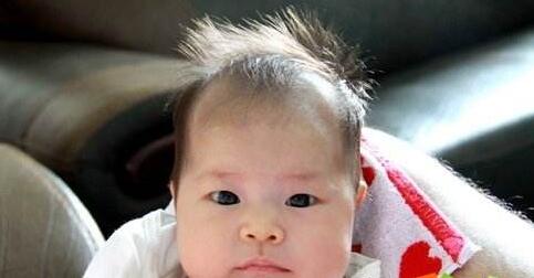 六个月_八个月宝宝额头前面头发变稀少了是什么原因引起的?