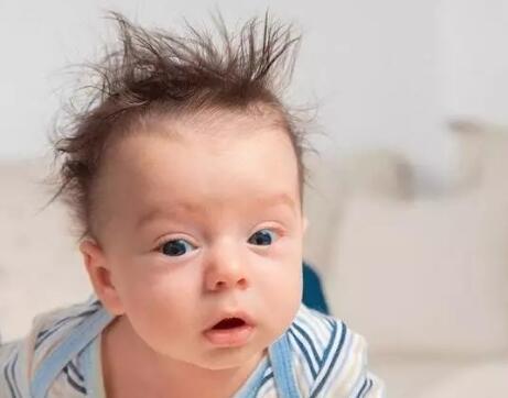 3个月_1岁_2岁宝宝鬓角_头顶头发发黄稀少怎么办?吃什么好?