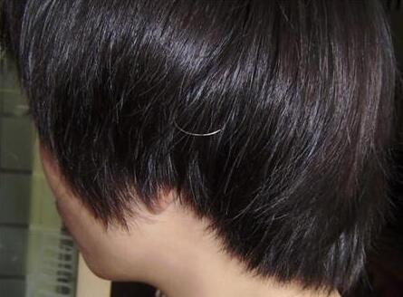 青少年脱发_白发的原因有哪些?是肾虚吗?白头发变黑的最快方法?