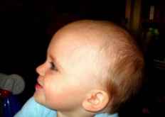 四个月宝宝大的头发掉了一块是怎么回事呢?缺铁吗?怎么办?